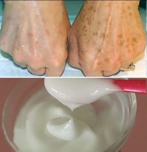 The Most Effective Cream Ingredients for Dark Spots and Signs of Skin Aging
