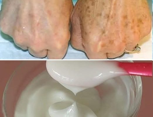 The Most Effective Cream Ingredients for Dark Spots and Signs of Skin Aging